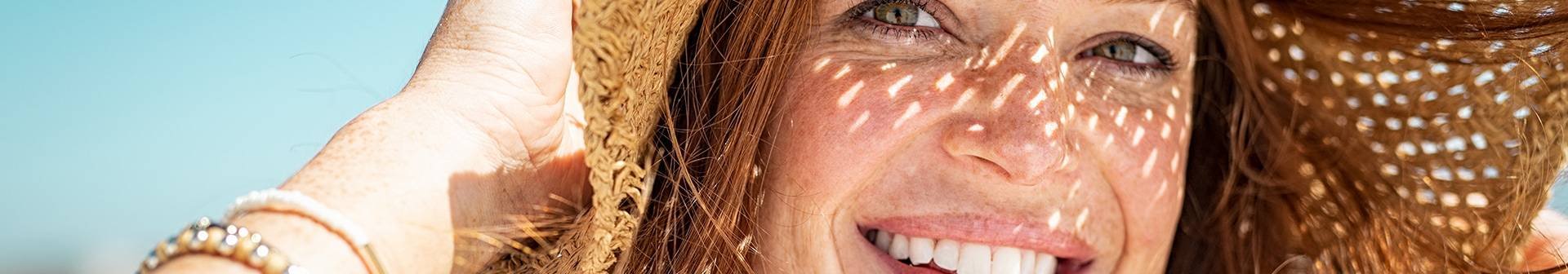 Frau mit Hut als Sonnenschutz vor Pigmentflecken