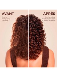 Image avant et après